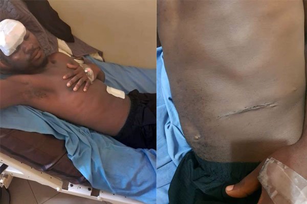 REMEMBER THE MAN WHO ACCUSED OLD KAMPALA HOSPITAL FOR KIDNEY HARVEST? Scans show he was actually Born with One Kidney!